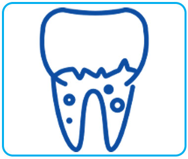 denitstas en Puebla Periodoncista